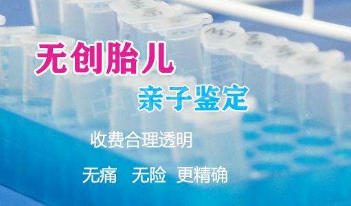 河北父亲和肚子里胎儿怎么做DNA鉴定,河北无创产前亲子鉴定大概多少费用